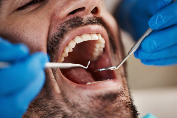 Best Emergency Broken Tooth Repair in Homer City, PA